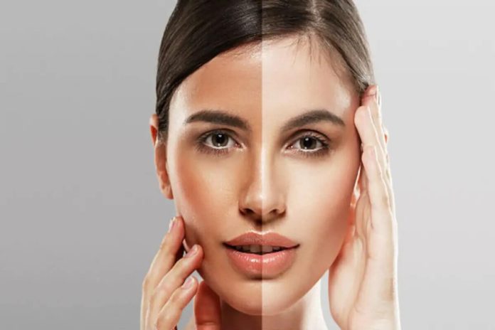 Guarantee-you-will-become-fair-follow-these-home-remedies
